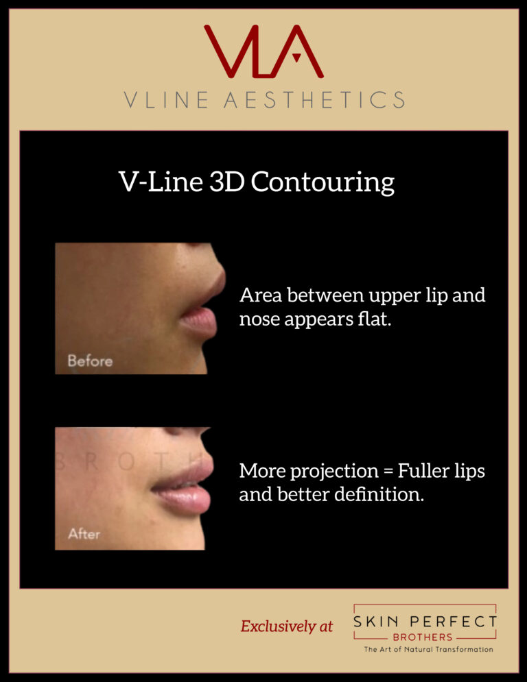 V Line Aesthetics 3 d contouring skin perfect brothers