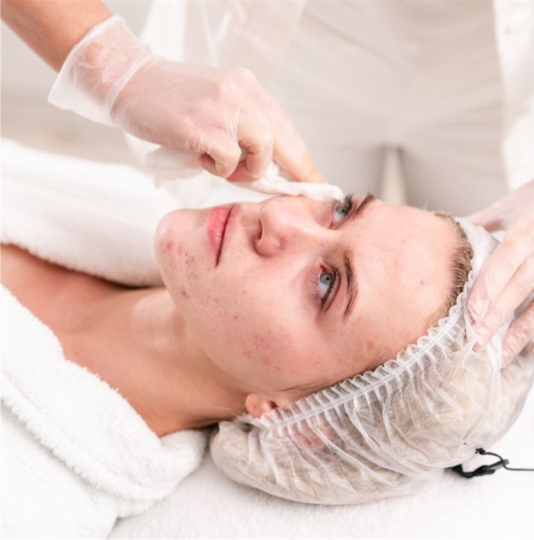 facial skin treatments