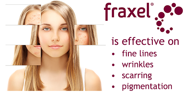 fraxel treatment effective skin perfect brothers