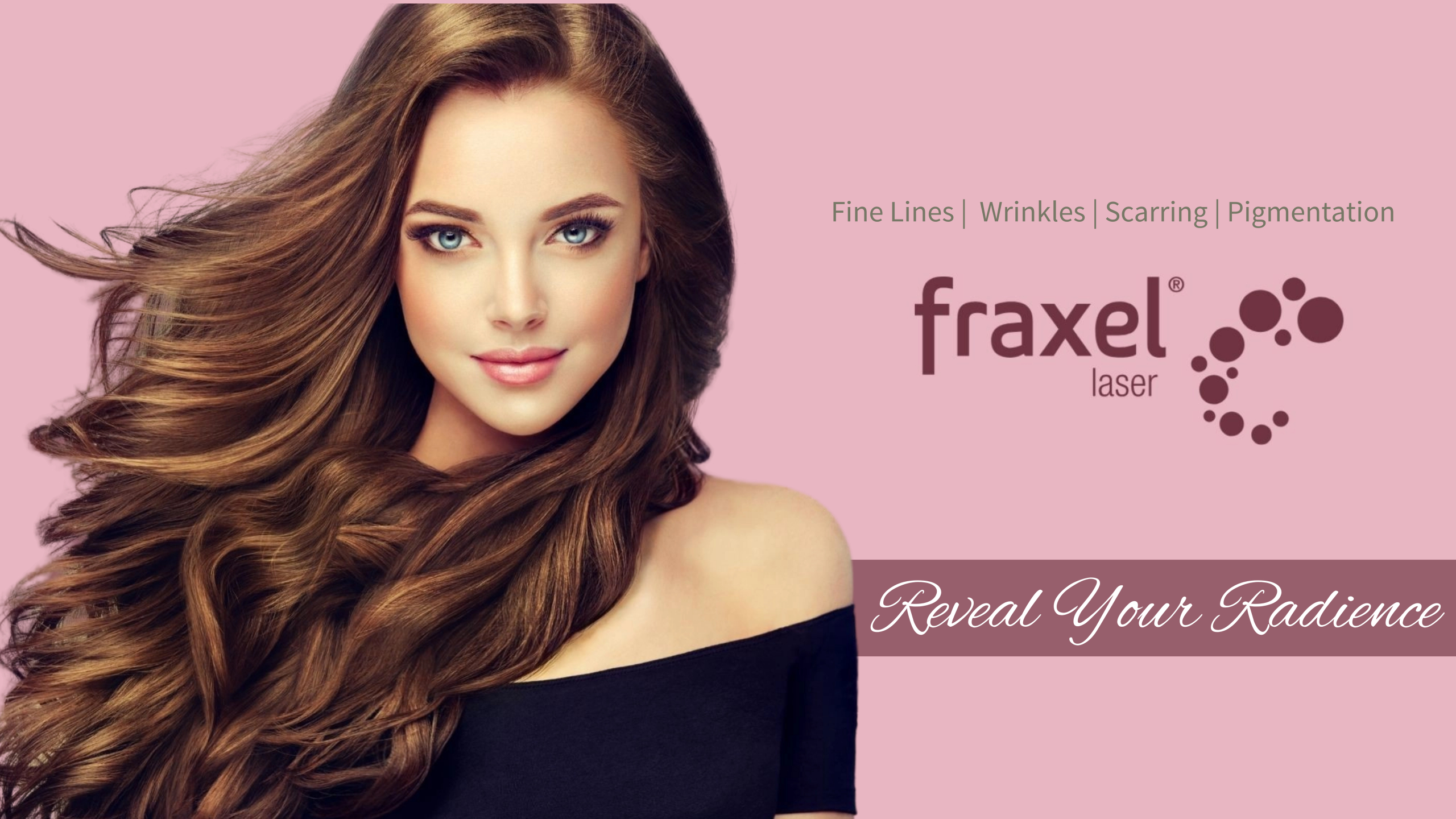 Skin Perfect Brothers Fraxel Laser Treatment