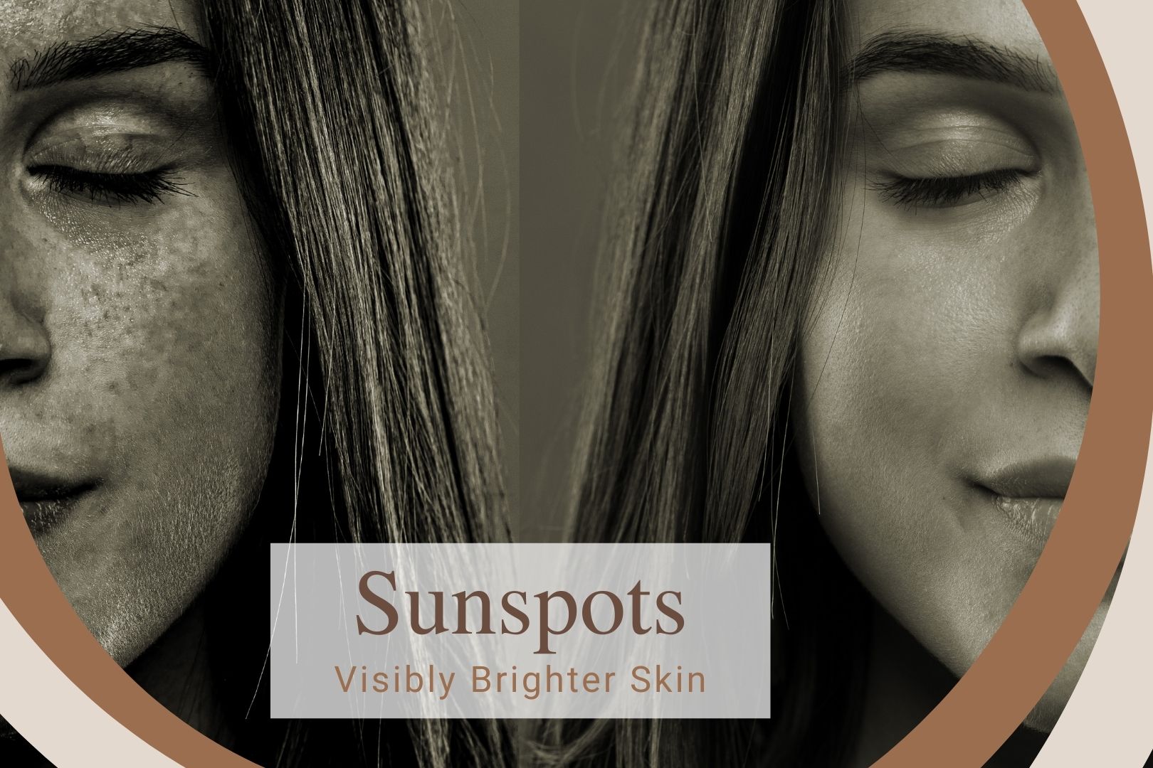sunspots skin perfect brothers