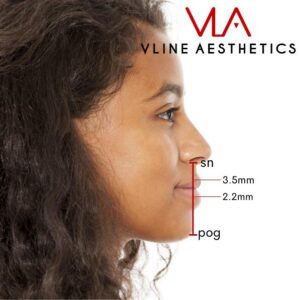 facial contour guide