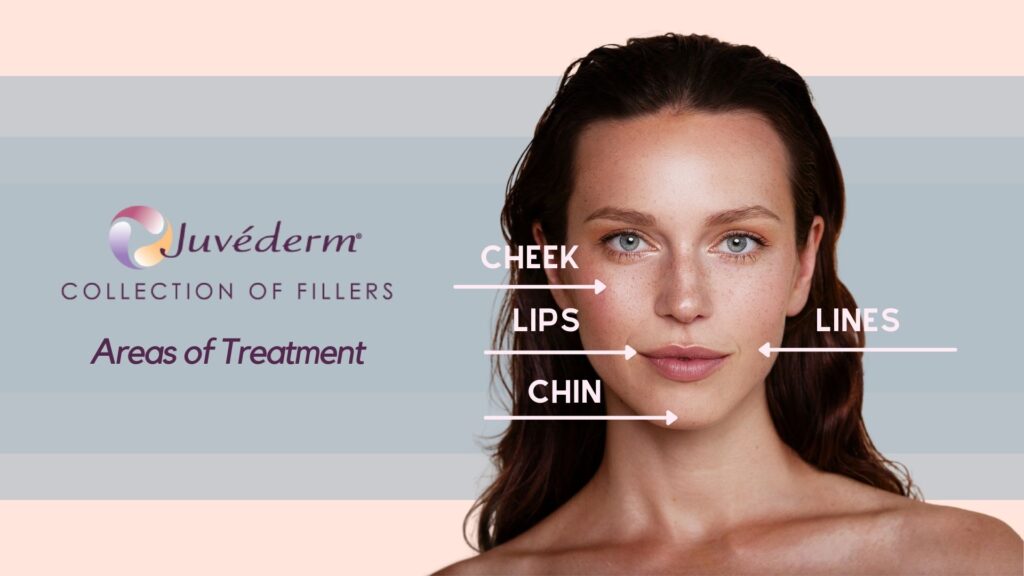 Juvederm areas of treatment skin perfect brothers