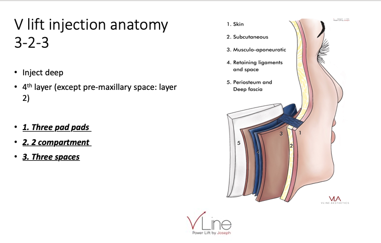 V Lift Injection Training - V Lift Anatomy