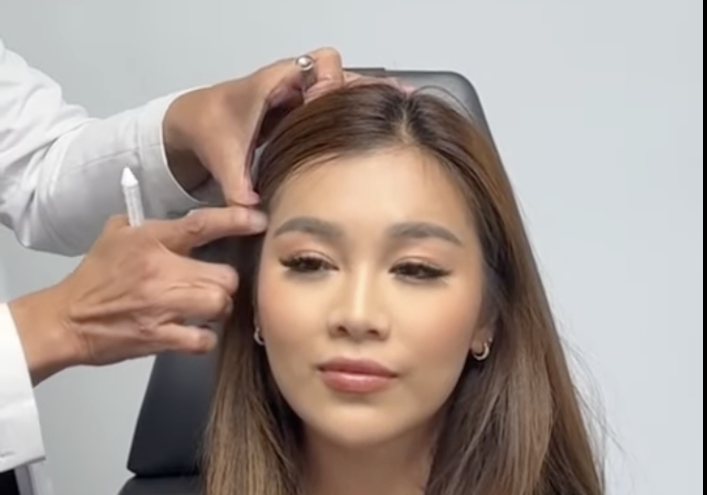 Advanced Injection Technique