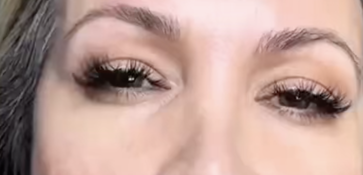 How To Avoid Swollen Undereyes